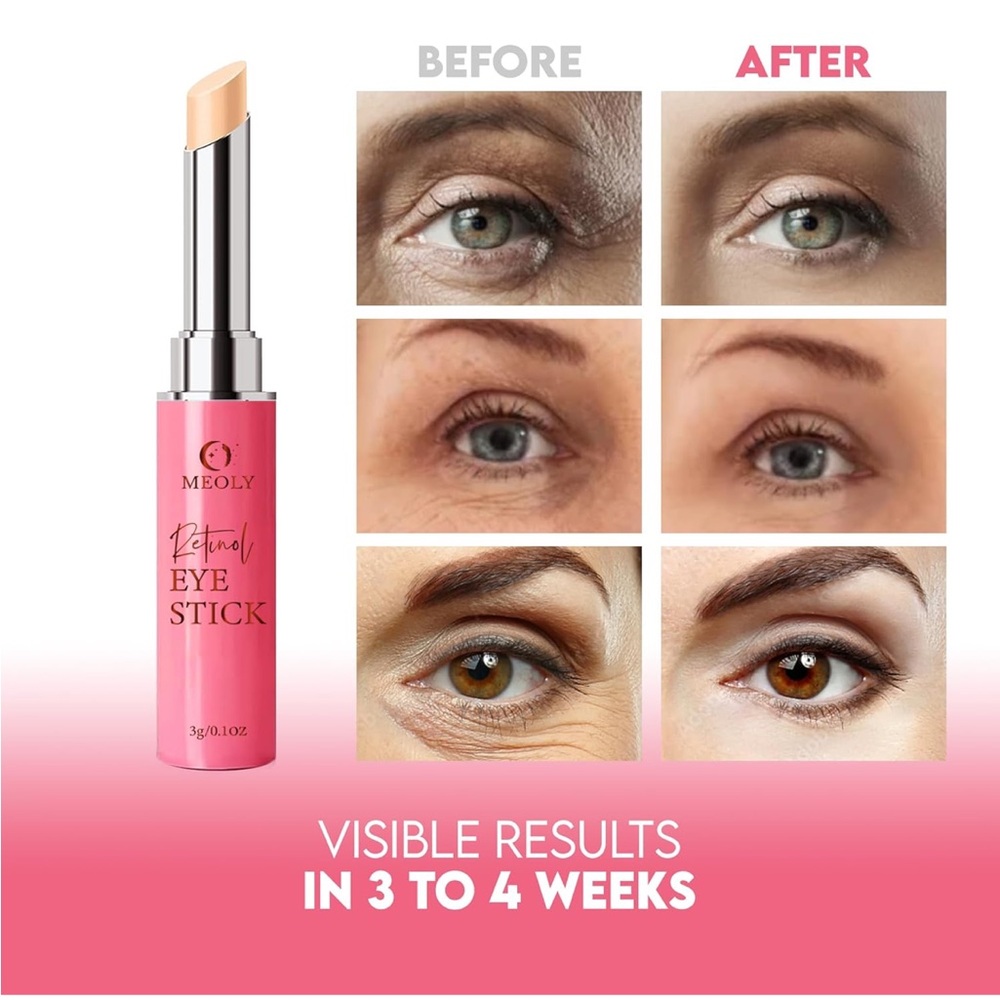 Retinol Anti Aging, Eye Cream for Wrinkles, Puffiness and Bags - Picture 6 of 10